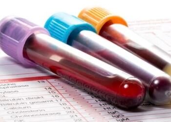 فصيلة الدم مؤشر جديد للتنبؤ بالسكري من النوع الثاني