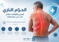 “الحزام الناري” الوعي والوقاية مفتاح الحد من مرض قد تستمر مضاعفاته لسنوات